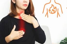 طرق طبيعية لعلاج حرقة المعدة والحموضة في المنزل بسرعة طرق طبيعية لعلاج حرقة المعدة والحموضة في المنزل بسرعة